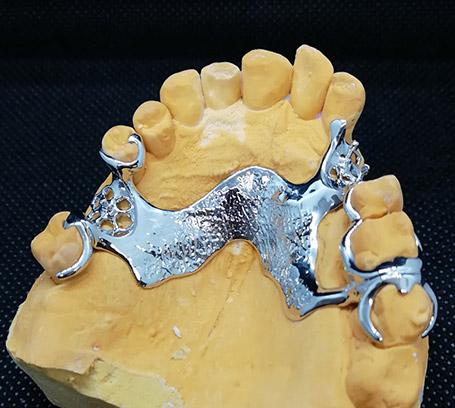 Prothèses dentaires amovibles