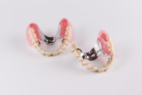 Appareils dentaires fixes en céramique